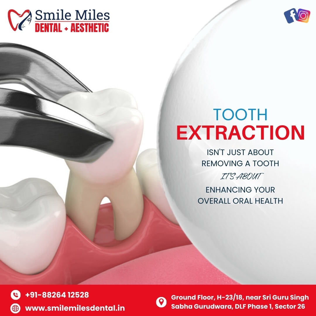 Painless Extraction